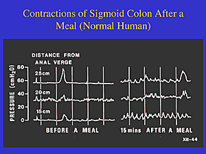 Normal Gut Contractions Graph