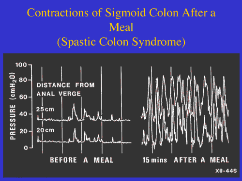 IBS Gut Contractions Graph