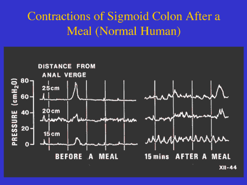 Normal Gut Contractions Graph